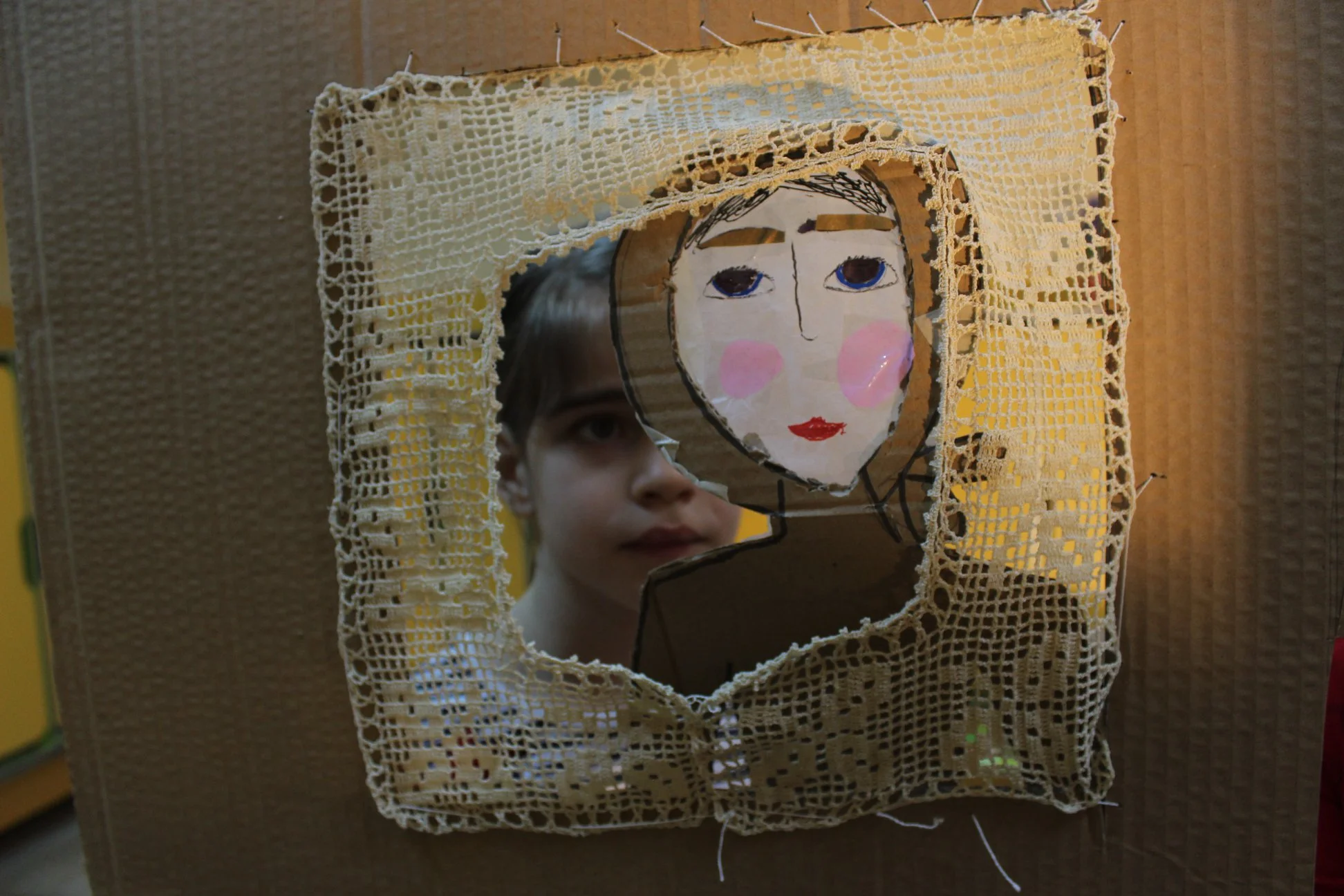 Am un dinte din față spart