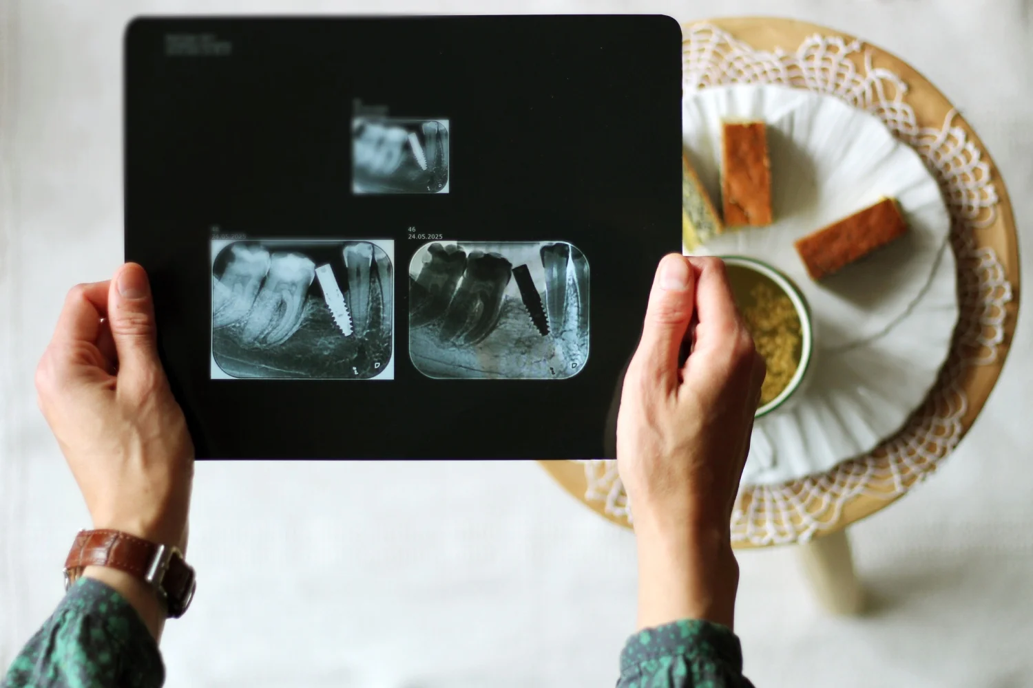 Păruta părere de sine